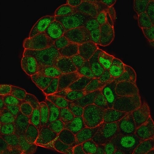 p27/Kip1 Antibody (SPM348) - IHC-Prediluted Immunocytochemistry/ Immunofluorescence: p27/Kip1 Antibody (SPM348) - IHC-Prediluted [NBP2-44494] -