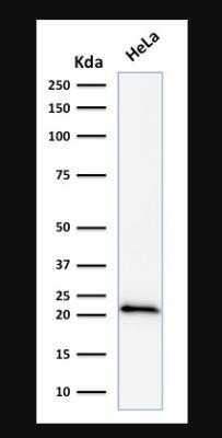 p21/CIP1/CDKN1A Antibody (DCS-60.2)