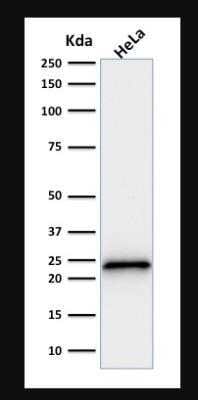 p21/CIP1/CDKN1A Antibody (SPM306)