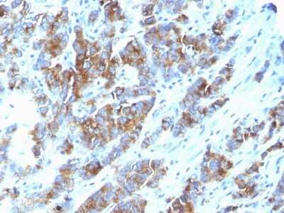 Myosin heavy chain 11 Antibody (ID8)