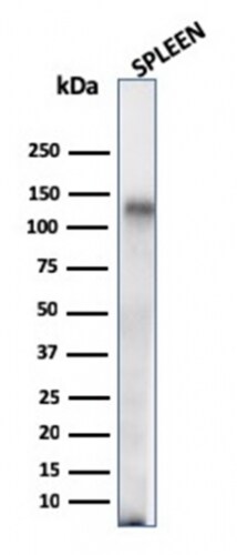 CD68/SR-D1 Antibody (C68/684) - IHC-Prediluted Western Blot: CD68/SR-D1 Antibody (C68/684) - IHC-Prediluted [NBP2-44541] -