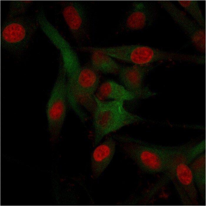 CD68/SR-D1 Antibody (C68/684) - IHC-Prediluted Immunocytochemistry/ Immunofluorescence: CD68/SR-D1 Antibody (C68/684) - IHC-Prediluted [NBP2-44541] -