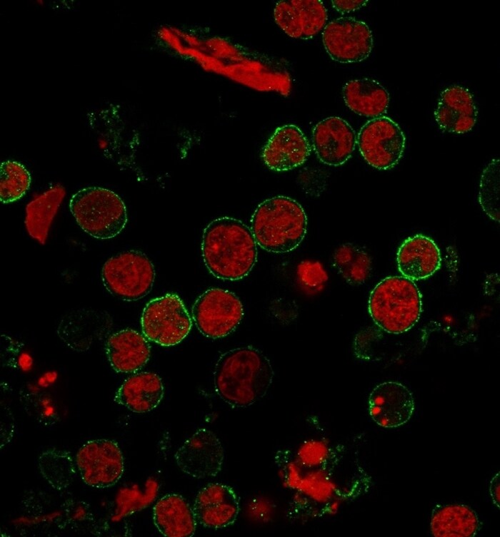 CD6 Antibody (C6/372) - IHC-Prediluted Immunocytochemistry/ Immunofluorescence: CD6 Antibody (C6/372) - IHC-Prediluted [NBP2-44554] -