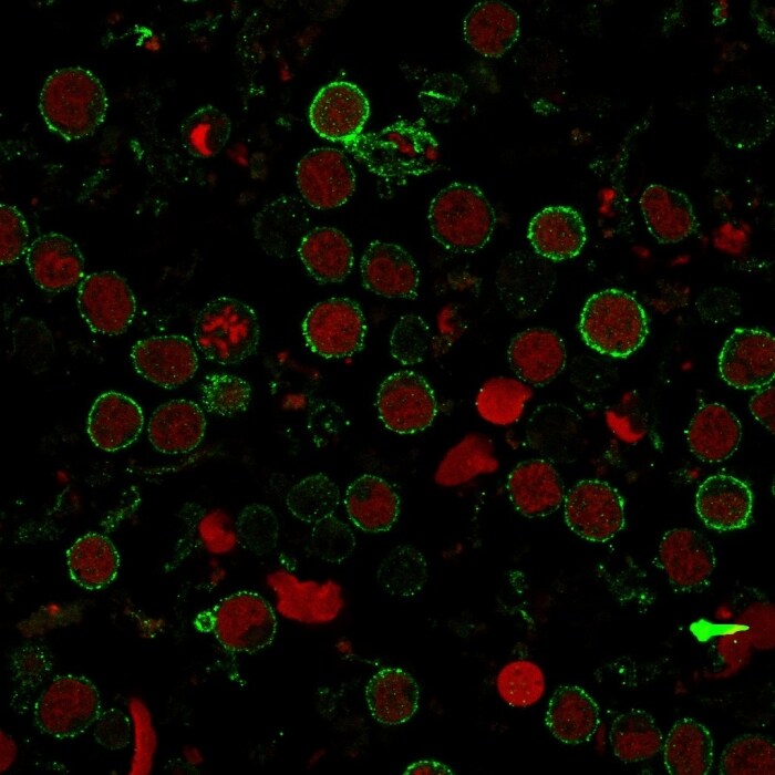 CD6 Antibody (SPM547) - IHC-Prediluted Immunocytochemistry/ Immunofluorescence: CD6 Antibody (SPM547) - IHC-Prediluted [NBP2-44555] -