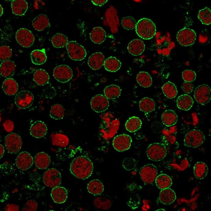 CD6 Antibody (C6/372+3F7B5) - IHC-Prediluted Immunocytochemistry/ Immunofluorescence: CD6 Antibody (C6/372+3F7B5) - IHC-Prediluted [NBP2-44557] -