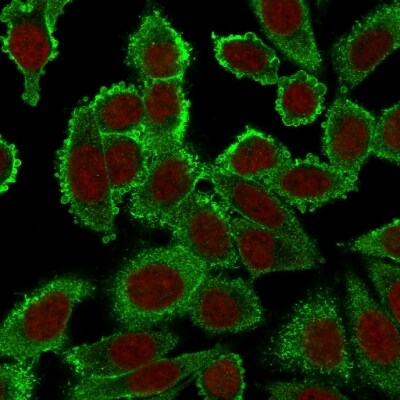 Moesin Antibody (SPM562) - IHC-Prediluted Immunocytochemistry/ Immunofluorescence: Moesin Antibody (SPM562) - IHC-Prediluted [NBP2-44578] -