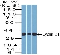 Cyclin D1 Antibody (DCS-6) - IHC-Prediluted Western Blot: Cyclin D1 Antibody (DCS-6) - IHC-Prediluted [NBP2-44584] -