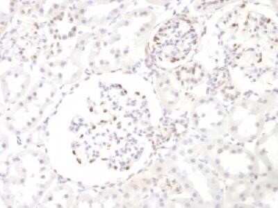 WT1 Antibody (WT1/857)