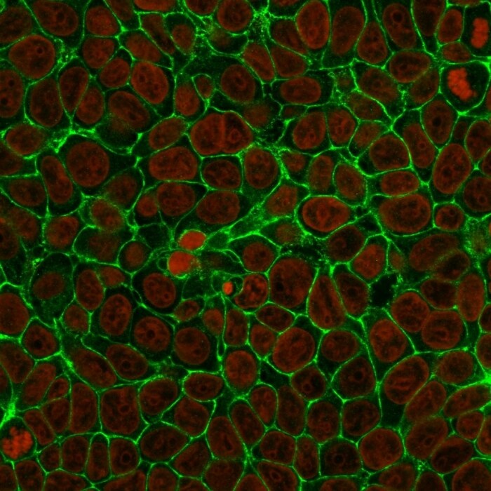 EpCAM/TROP1 Antibody (VU-1D9) - IHC-Prediluted Immunocytochemistry/ Immunofluorescence: EpCAM/TROP1 Antibody (VU-1D9) - IHC-Prediluted [NBP2-44638] -