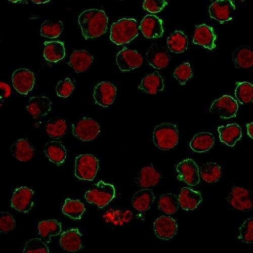 CD43/Sialophorin Antibody (SPM503) - IHC-Prediluted Immunocytochemistry/ Immunofluorescence: CD43/Sialophorin Antibody (SPM503) - IHC-Prediluted [NBP2-44647] -