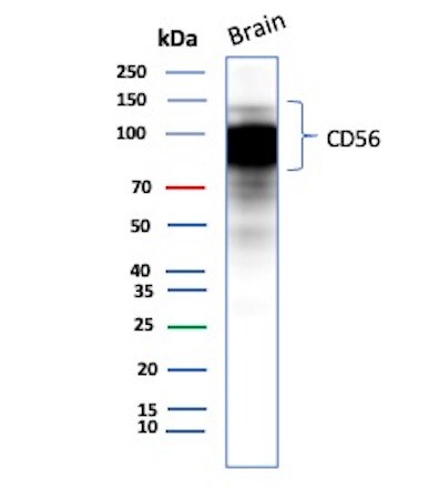 NCAM-1/CD56 Antibody (123A8 (same as 56C04)) - IHC-Prediluted Western Blot: NCAM-1/CD56 Antibody (123A8 (same as 56C04)) - IHC-Prediluted [NBP2-44713] -