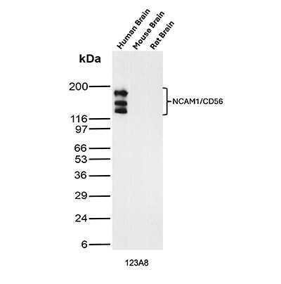 NCAM-1/CD56 Antibody (123A8 (same as 56C04)) - IHC-Prediluted Western Blot: NCAM-1/CD56 Antibody (123A8 (same as 56C04)) - IHC-Prediluted [NBP2-44713] -