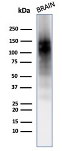 NCAM-1/CD56 Antibody (123A8 (same as 56C04)) - IHC-Prediluted Western Blot: NCAM-1/CD56 Antibody (123A8 (same as 56C04)) - IHC-Prediluted [NBP2-44713] -