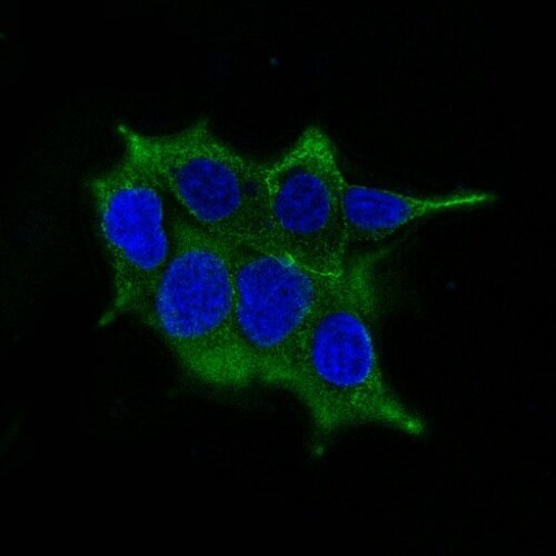 Ornithine Decarboxylase Antibody (ODC1/485) - IHC-Prediluted Immunocytochemistry/ Immunofluorescence: Ornithine Decarboxylase Antibody (ODC1/485) - IHC-Prediluted [NBP2-44732] -