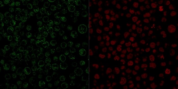 CD79A Antibody (JCB117) - IHC-Prediluted Immunocytochemistry/ Immunofluorescence: CD79A Antibody (JCB117) - IHC-Prediluted [NBP2-44736] -