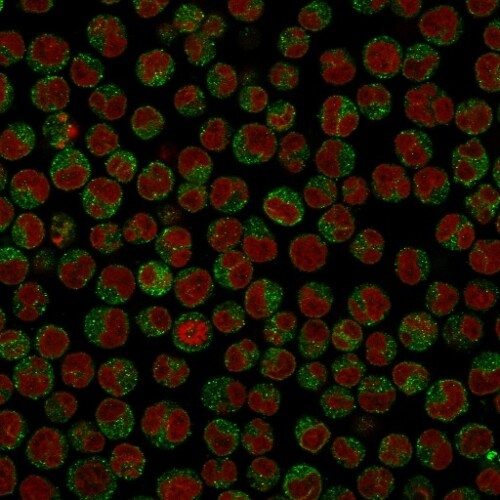 CD79A Antibody (SPM549) - IHC-Prediluted Immunocytochemistry/ Immunofluorescence: CD79A Antibody (SPM549) - IHC-Prediluted [NBP2-44737] -