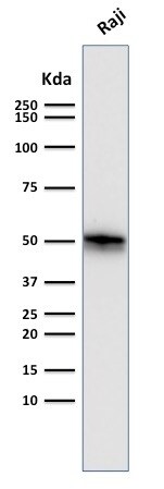 CD79A Antibody (SPM550) - IHC-Prediluted Western Blot: CD79A Antibody (SPM550) - IHC-Prediluted [NBP2-44739] -