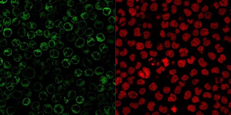 CD79A Antibody (JCB117 + HM47/A9) - IHC-Prediluted Immunocytochemistry/ Immunofluorescence: CD79A Antibody (JCB117 + HM47/A9) - IHC-Prediluted [NBP2-44740] -