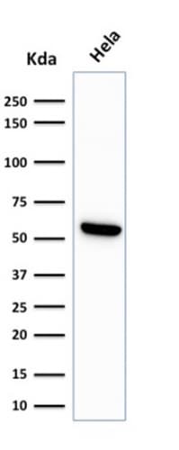 HSP60 Antibody (LK1) - IHC-Prediluted Western Blot: HSP60 Antibody (LK1) - IHC-Prediluted [NBP2-44754] -
