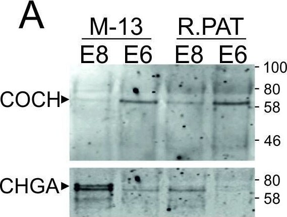 Chromogranin A Antibody (CHGA/777)