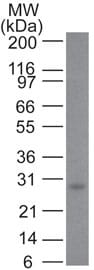 Bcl-2 Antibody (100/D5+124) - IHC-Prediluted Western Blot: Bcl-2 Antibody (100/D5+124) - IHC-Prediluted [NBP2-44782] -