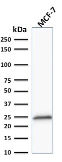 Bcl-2 Antibody (100/D5+124) - IHC-Prediluted Western Blot: Bcl-2 Antibody (100/D5+124) - IHC-Prediluted [NBP2-44782] -