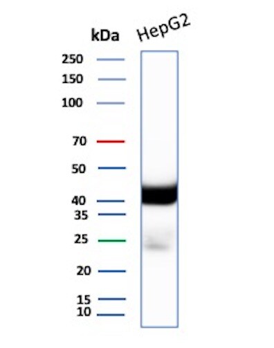 CD7 Antibody (B-F12) Western Blot: CD7 Antibody (B-F12) [NBP2-44799] -