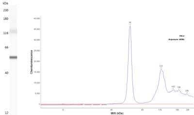 Cytokeratin 7 Antibody (OV-TL12/30)