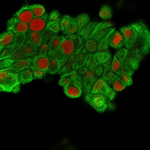 Cytokeratin 19 Antibody (SPM561) - IHC-Prediluted Immunocytochemistry/ Immunofluorescence: Cytokeratin 19 Antibody (SPM561) - IHC-Prediluted [NBP2-44824] -