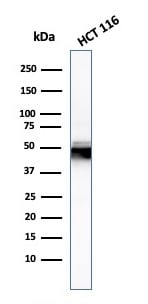 Cytokeratin 8 Antibody (H1) - IHC-Prediluted Western Blot: Cytokeratin 8 Antibody (H1) - IHC-Prediluted [NBP2-44932] -