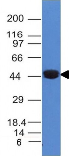 Cytokeratin 8 Antibody (K8/383) - IHC-Prediluted Western Blot: Cytokeratin 8 Antibody (K8/383) - IHC-Prediluted [NBP2-44934] -