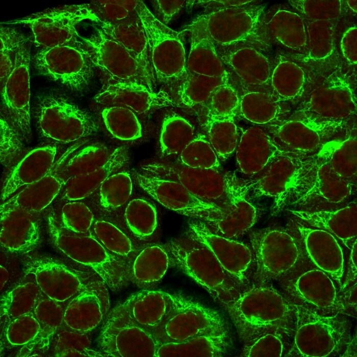 Cytokeratin 8 Antibody (K8/383) - IHC-Prediluted Immunocytochemistry/ Immunofluorescence: Cytokeratin 8 Antibody (K8/383) - IHC-Prediluted [NBP2-44934] -