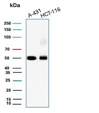 Cytokeratin 8 Antibody (TS1) - IHC-Prediluted Western Blot: Cytokeratin 8 Antibody (TS1) - IHC-Prediluted [NBP2-44935] -