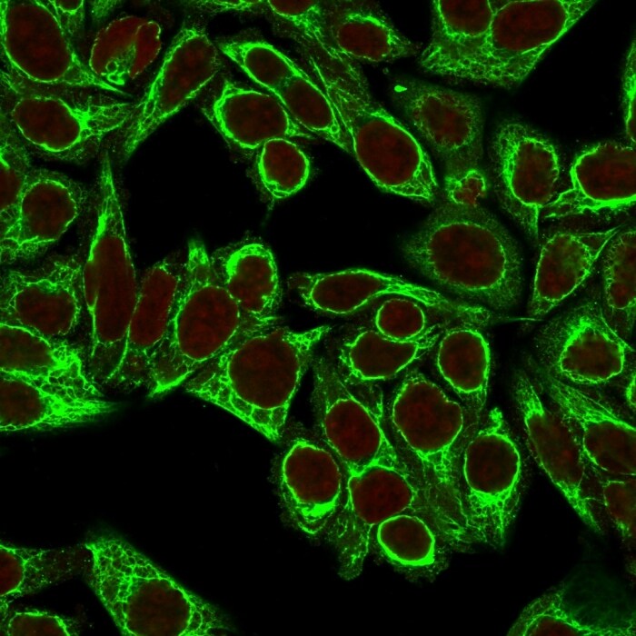 Cytokeratin 8 Antibody (H1+TS1) - IHC-Prediluted Immunocytochemistry/ Immunofluorescence: Cytokeratin 8 Antibody (H1+TS1) - IHC-Prediluted [NBP2-44937] -