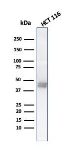 Cytokeratin 8 Antibody (K8.8) - IHC-Prediluted Western Blot: Cytokeratin 8 Antibody (K8.8) - IHC-Prediluted [NBP2-44939] -