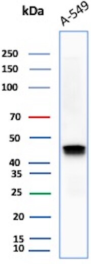Cytokeratin 18 Antibody (DC10) - IHC-Prediluted Western Blot: Cytokeratin 18 Antibody (DC10) - IHC-Prediluted [NBP2-44943] -