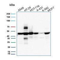 Cytokeratin 18 Antibody (DC10) - IHC-Prediluted Western Blot: Cytokeratin 18 Antibody (DC10) - IHC-Prediluted [NBP2-44943] -
