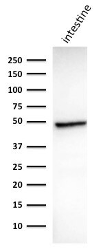 Cytokeratin 18 Antibody (DC10) - IHC-Prediluted Western Blot: Cytokeratin 18 Antibody (DC10) - IHC-Prediluted [NBP2-44943] -