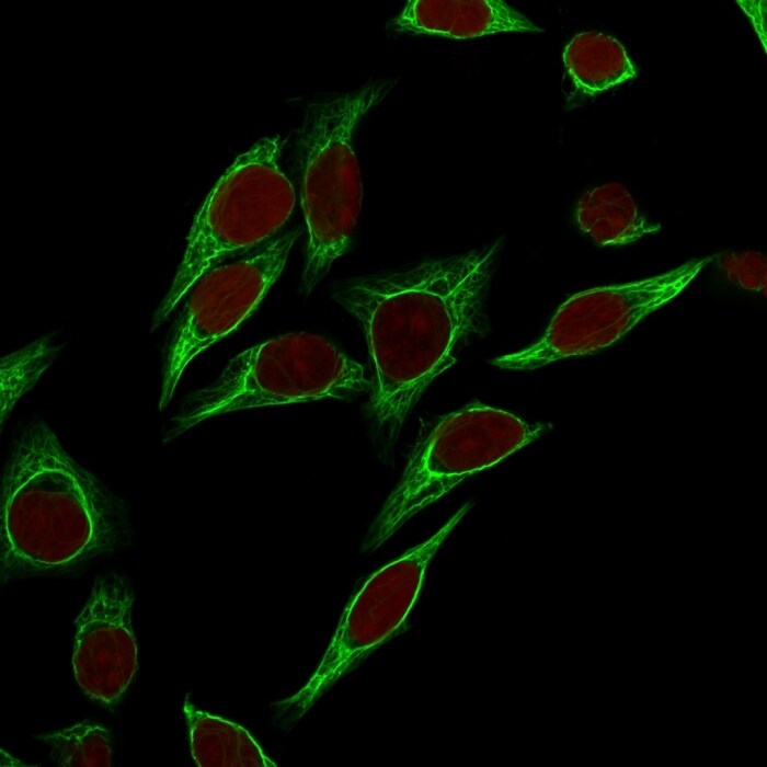 Cytokeratin 18 Antibody (SPM265) - IHC-Prediluted Immunocytochemistry/ Immunofluorescence: Cytokeratin 18 Antibody (SPM265) - IHC-Prediluted [NBP2-44944] -