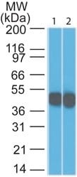 Cytokeratin 18 Antibody (SPM265) - IHC-Prediluted Western Blot: Cytokeratin 18 Antibody (SPM265) - IHC-Prediluted [NBP2-44944] -