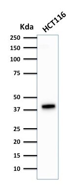 Cytokeratin 18 Antibody (DA7) - IHC-Prediluted Western Blot: Cytokeratin 18 Antibody (DA7) - IHC-Prediluted [NBP2-44945] -