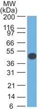 Cytokeratin 18 Antibody (DA7) - IHC-Prediluted Western Blot: Cytokeratin 18 Antibody (DA7) - IHC-Prediluted [NBP2-44945] -