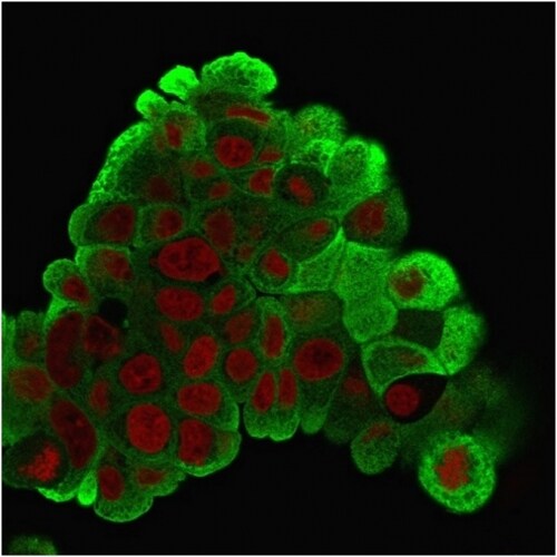 HSP27 Antibody (G3.1) - IHC-Prediluted Immunocytochemistry/ Immunofluorescence: HSP27 Antibody (G3.1) - IHC-Prediluted [NBP2-44973] -