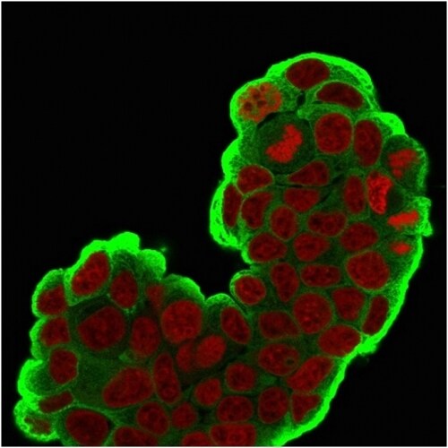 HSP27 Antibody (SPM252) - IHC-Prediluted Immunocytochemistry/ Immunofluorescence: HSP27 Antibody (SPM252) - IHC-Prediluted [NBP2-44974] -