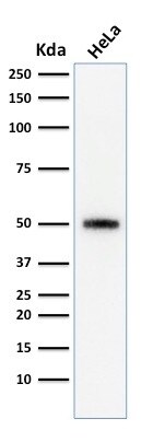 p53 Antibody (SPM590) - IHC-Prediluted Western Blot: p53 Antibody (SPM590) - IHC-Prediluted [NBP2-44979] -