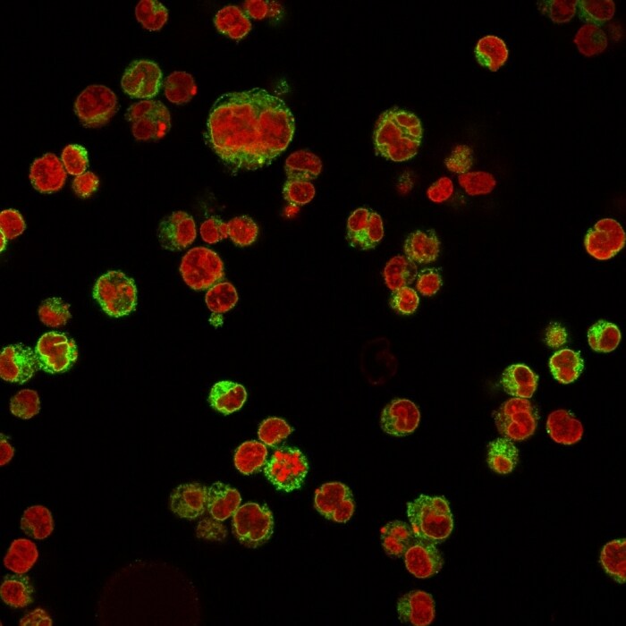 CD74 Antibody (LN-2) - IHC-Prediluted Immunocytochemistry/ Immunofluorescence: CD74 Antibody (LN-2) - IHC-Prediluted [NBP2-44988] -