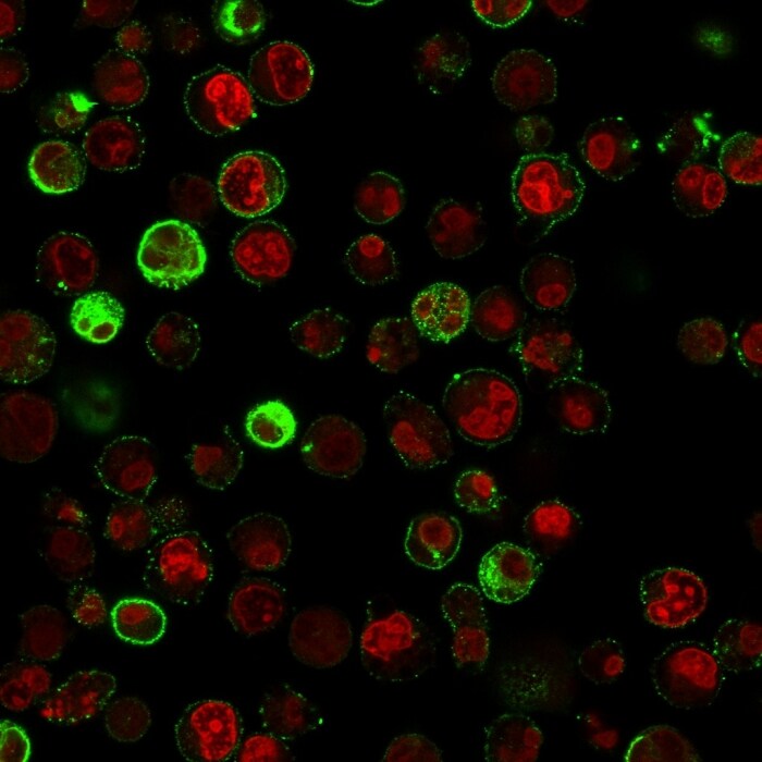 CD74 Antibody (SPM523) - IHC-Prediluted Immunocytochemistry/ Immunofluorescence: CD74 Antibody (SPM523) - IHC-Prediluted [NBP2-44989] -