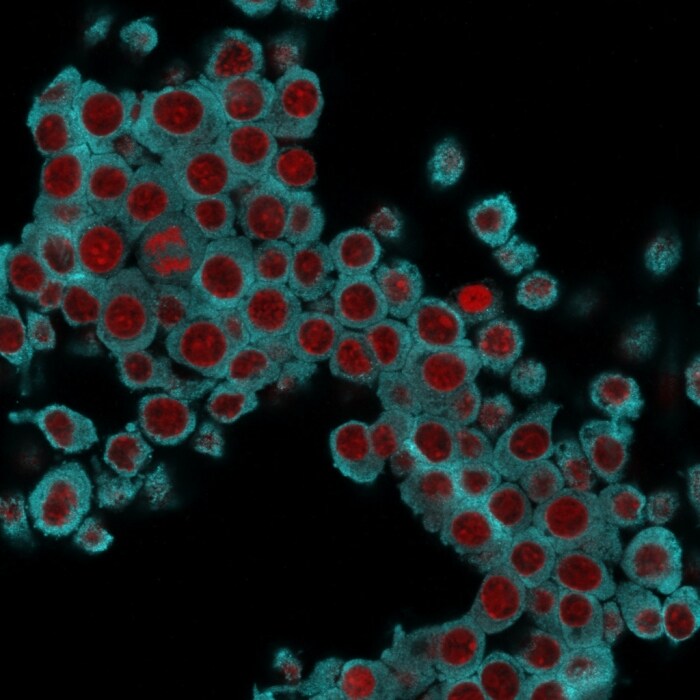 Cytokeratin 6 Antibody (SPM269) - IHC-Prediluted Immunocytochemistry/ Immunofluorescence: Cytokeratin 6 Antibody (SPM269) - IHC-Prediluted [NBP2-45025] -