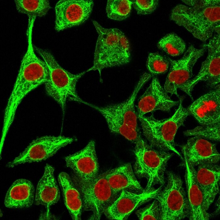 Cytokeratin 14 Antibody (SPM263) - IHC-Prediluted Immunocytochemistry/ Immunofluorescence: Cytokeratin 14 Antibody (SPM263) - IHC-Prediluted [NBP2-45030] -