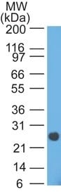 Lambda Light Chain Antibody (HP6054) - IHC-Prediluted Western Blot: Lambda Light Chain Antibody (HP6054) - IHC-Prediluted [NBP2-45074] -